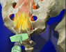Spine Surgeries