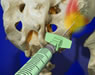Spine Surgeries