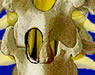 Spine Surgeries