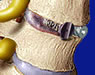 Spine Surgeries
